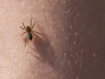 Spider Bite